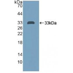 Protein Tyrosine Phosphatase Receptor Type H (PTPRH) Antibody