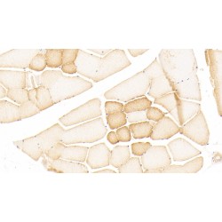 Neuromedin U (NMU) Antibody