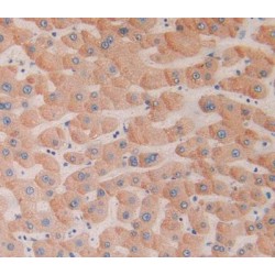 Ectonucleoside Triphosphate Diphosphohydrolase 1 (ENTPD1) Antibody