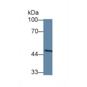 Western blot analysis of Mouse Spleen lysate, using Human CASP10 Antibody (5 µg/ml) and HRP-conjugated Goat Anti-Rabbit antibody (<a href="https://www.abbexa.com/index.php?route=product/search&amp;search=abx400043" target="_blank">abx400043</a>, 0.2 µg/ml).