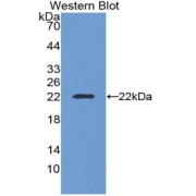 Western blot analysis of the recombinant protein.