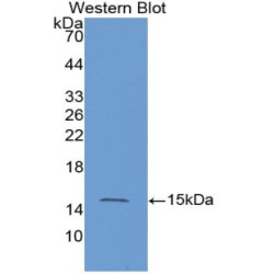 GTPase HRas (HRAS) Antibody