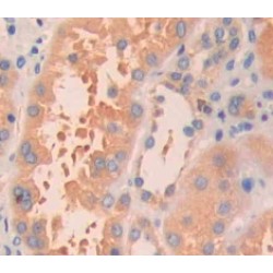 GTPase HRas (HRAS) Antibody