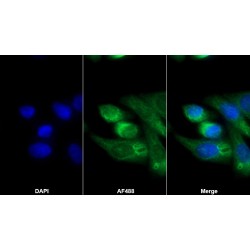 Agrin (AGRN) Antibody