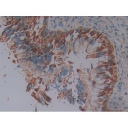 Squamous Cell Carcinoma Antigen 1 (SCCA1) Antibody