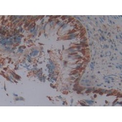 Squamous Cell Carcinoma Antigen 1 (SCCA1) Antibody