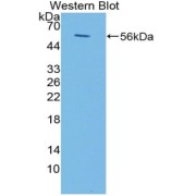 Western blot analysis of recombinant Human FCAR.