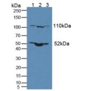 Western blot analysis of (1) Human Lung Tissue, (2) Human MCF-7 Cells and (3) Mouse Thymus Tissue.