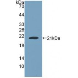 Nucleoporin 210 kDa / gp210 (NUP210) Antibody