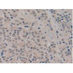 Nucleoporin 210 kDa / gp210 (NUP210) Antibody