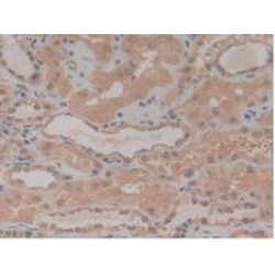 Nucleoporin 210 kDa / gp210 (NUP210) Antibody