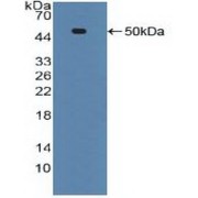 Western blot analysis of recombinant Human ADRbK1.