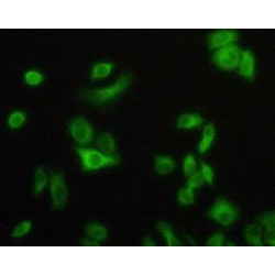 Tumor Necrosis Factor Receptor Superfamily Member 1A / CD120a (TNFRSF1A) Antibody