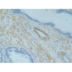 Tumor Necrosis Factor Receptor Superfamily Member 1A / CD120a (TNFRSF1A) Antibody