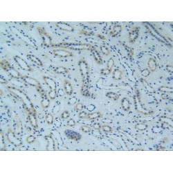 Tumor Necrosis Factor Receptor Superfamily Member 1A / CD120a (TNFRSF1A) Antibody