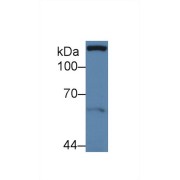 Western blot analysis of Human MCF7 cell lysate, using Human Pax Antibody (3 µg/ml) and HRP-conjugated Goat Anti-Rabbit antibody (<a href="https://www.abbexa.com/index.php?route=product/search&amp;search=abx400043" target="_blank">abx400043</a>, 0.2 µg/ml).