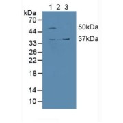 Western blot analysis of (1) Human HepG2 Cells, (2) Human Jurkat Cells and (3) Mouse Kidney Tissue.