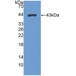 S100 Calcium Binding Protein A2 (S100A2) Antibody