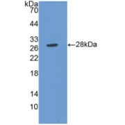 Western blot analysis of recombinant Human MMP14.