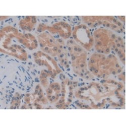 Matrix Metalloproteinase 14 (MMP14) Antibody