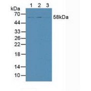 Western blot analysis of (1) Human HeLa cells, (2) Human 293T Cells and (3) Human HepG2 Cells.