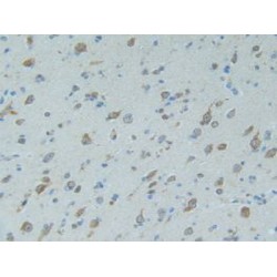 Mothers Against Decapentaplegic Homolog 9 (Smad9) Antibody