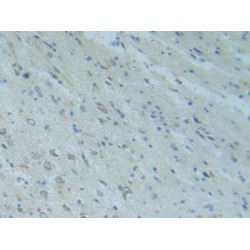 Mothers Against Decapentaplegic Homolog 9 (Smad9) Antibody