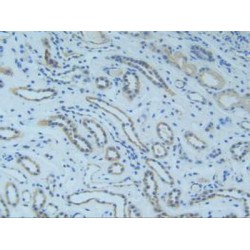 Mothers Against Decapentaplegic Homolog 9 (Smad9) Antibody