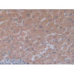 5'-Nucleotidase, Cytosolic III (NT5C3) Antibody