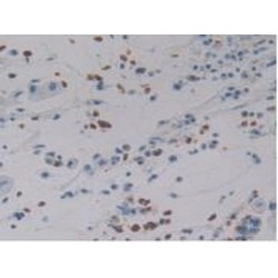 Defensin Alpha 4, Corticostatin (DEFa4) Antibody