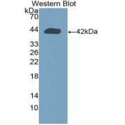 Western blot analysis of the recombinant protein.