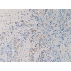 Signal Regulatory Protein Alpha (SIRPa) Antibody