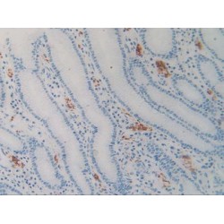 Signal Regulatory Protein Alpha (SIRPa) Antibody