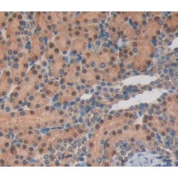 Poly ADP Ribose Polymerase 1 (PARP1) Antibody