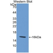 Western blot analysis of the recombinant protein.