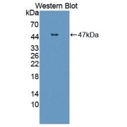 Western blot analysis of the recombinant protein.