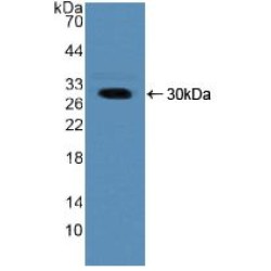 Nucleoporin 50 kDa (NUP50) Antibody