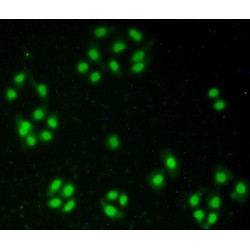 Nucleoporin 50 kDa (NUP50) Antibody