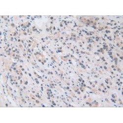 Nucleoporin 50 kDa (NUP50) Antibody