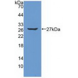 Serine Protease 2 (PRSS2) Antibody