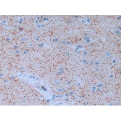 Serine Protease 2 (PRSS2) Antibody