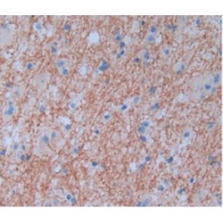 Serine Protease 2 (PRSS2) Antibody