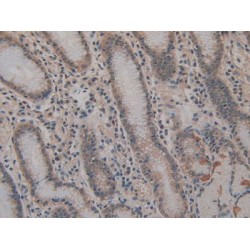 Basigin (BSG) Antibody