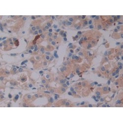 Latent Transforming Growth Factor Beta Binding Protein 2 (LTBP2) Antibody