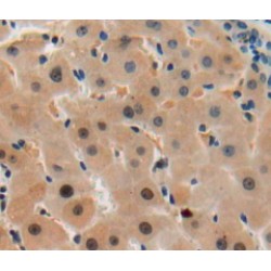 Serum/Glucocorticoid Regulated Kinase 2 (SGK2) Antibody