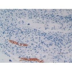 Pigment Epithelium-Derived Factor / PEDF (SERPINF1) Antibody