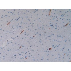 Pigment Epithelium-Derived Factor / PEDF (SERPINF1) Antibody