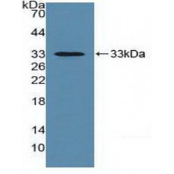 HLA Class I Histocompatibility Antigen, C Alpha Chain (HLA-C) Antibody