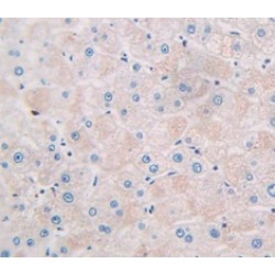 Macrophage Inflammatory Protein 4 Alpha (MIP4a) Antibody