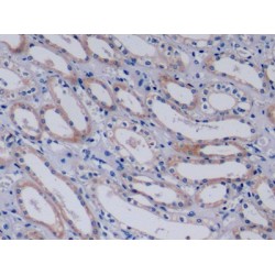 Collagen Type IV Alpha 3 (COL4A3) Antibody